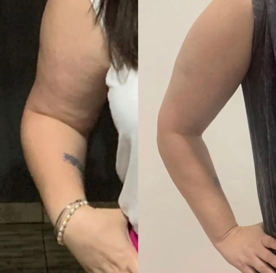 Before and after photos shared by Amanda S.