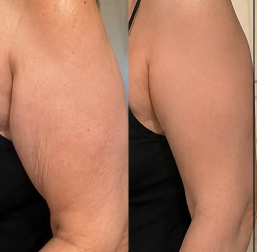 Before and after photos shared by Diane M.