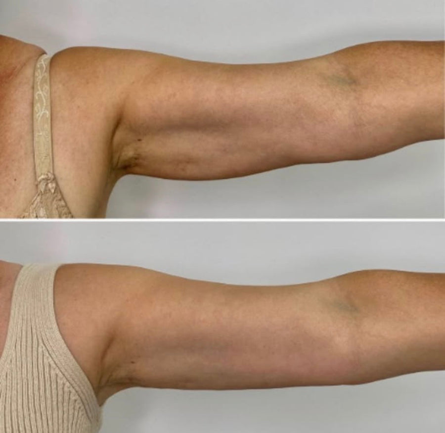 Before and after photos shared by Helen P.