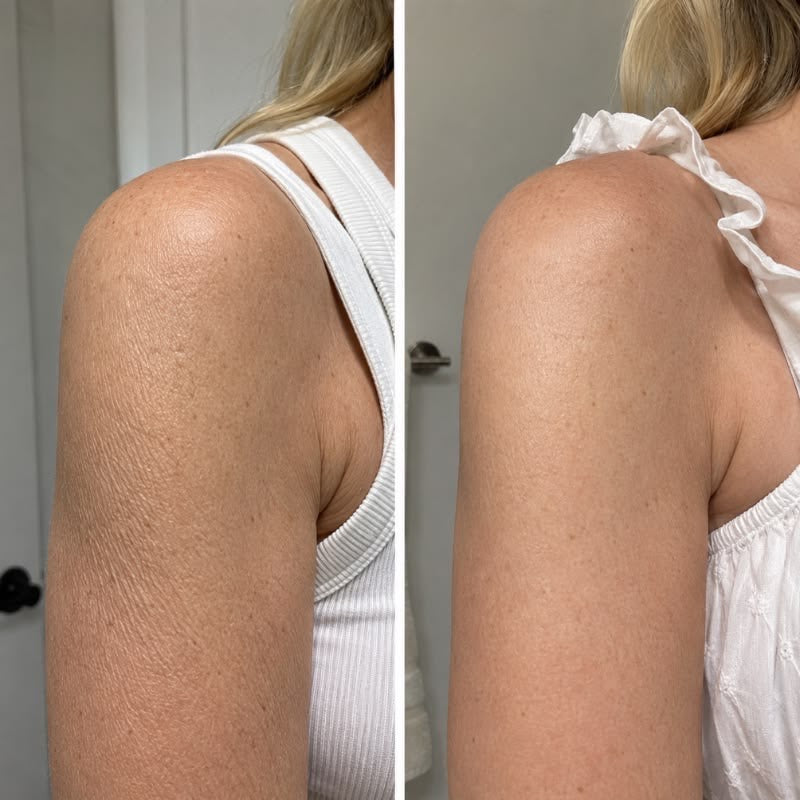Before and after photos shared by Helen R.