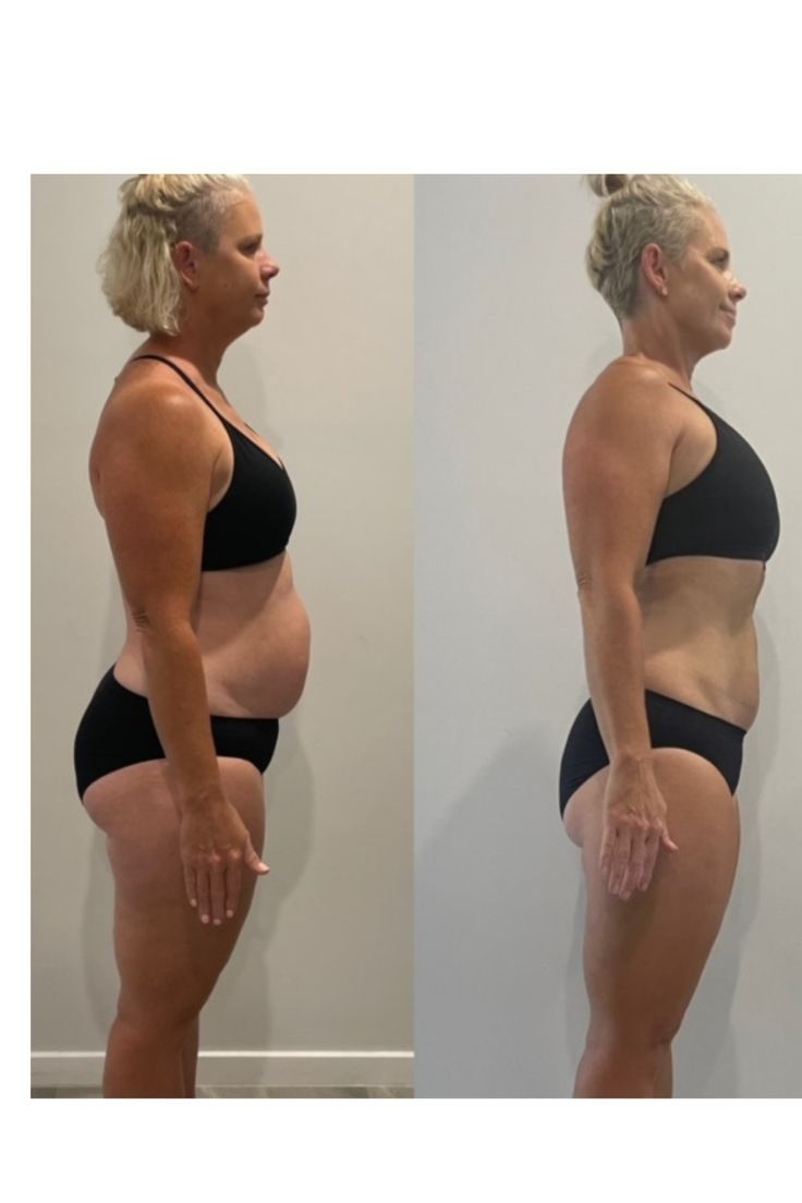 Before and after photos shared by Karen D.