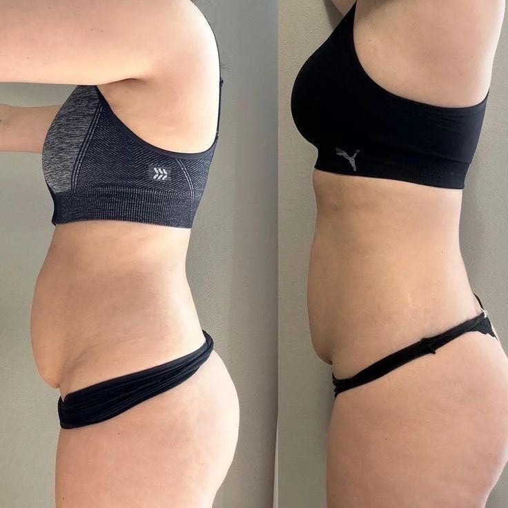 Before and after photos shared by Margaret L.