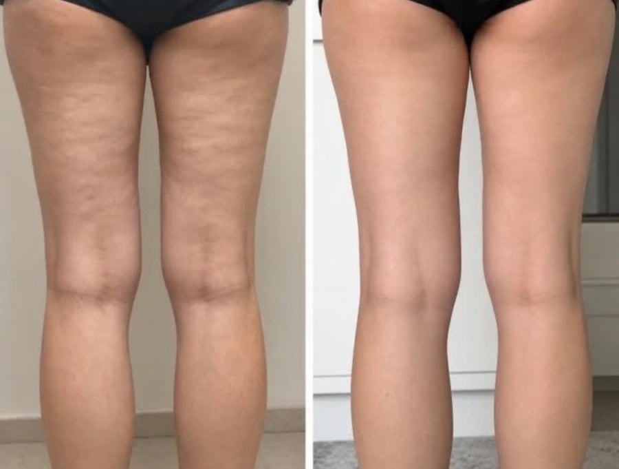 Before and after photos shared by Nicole T.