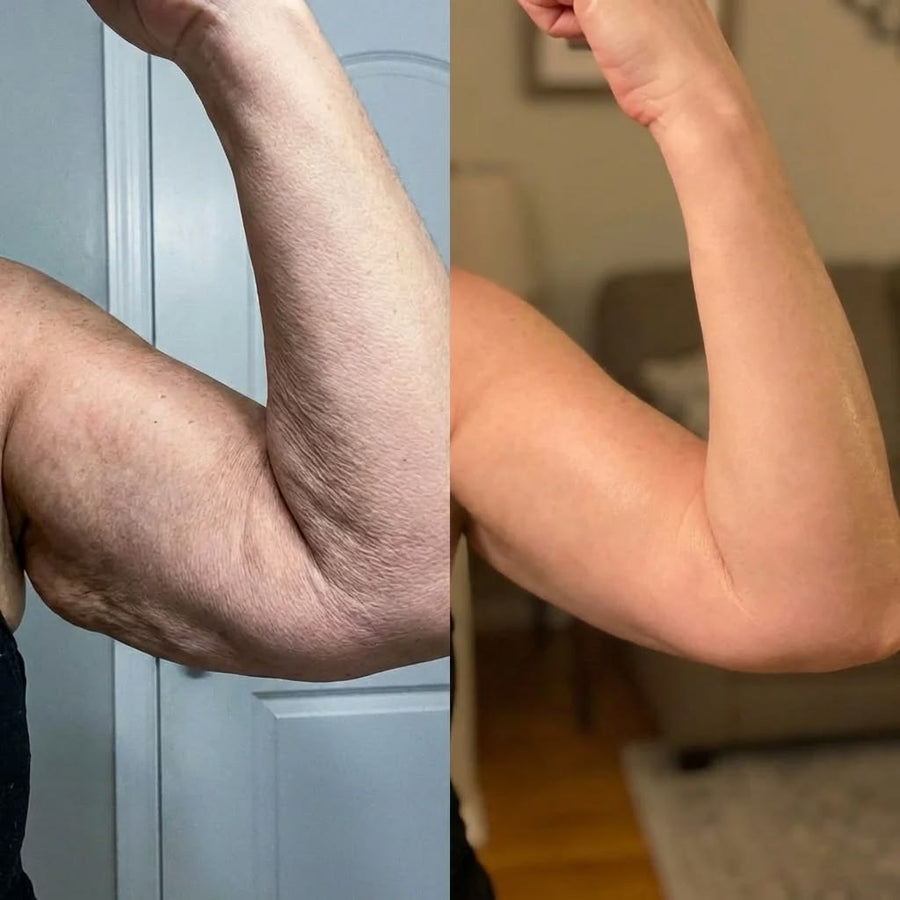 Before and after photos shared by Patricia L.
