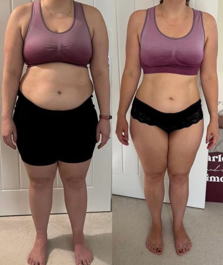 Before and after photos shared by Samantha W.
