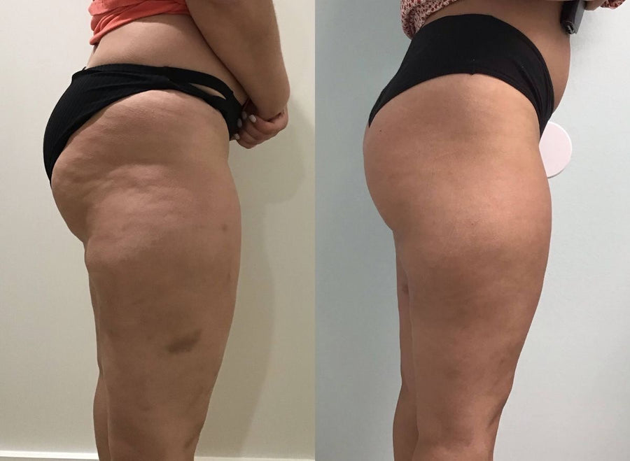 Before and after photos shared by Tina W.